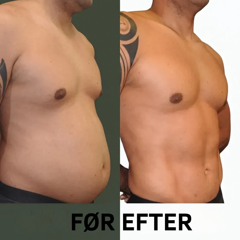 Castorolie Detox-pakke