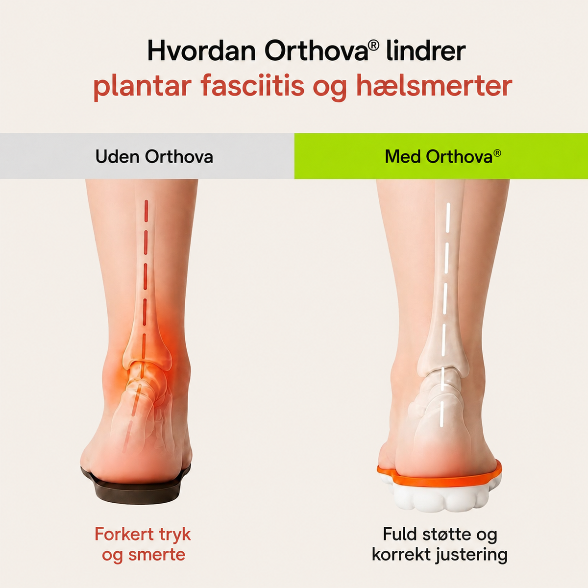 Orthova™ | Aflastende indlægssåler mod hælsmerter og plantar fasciitis